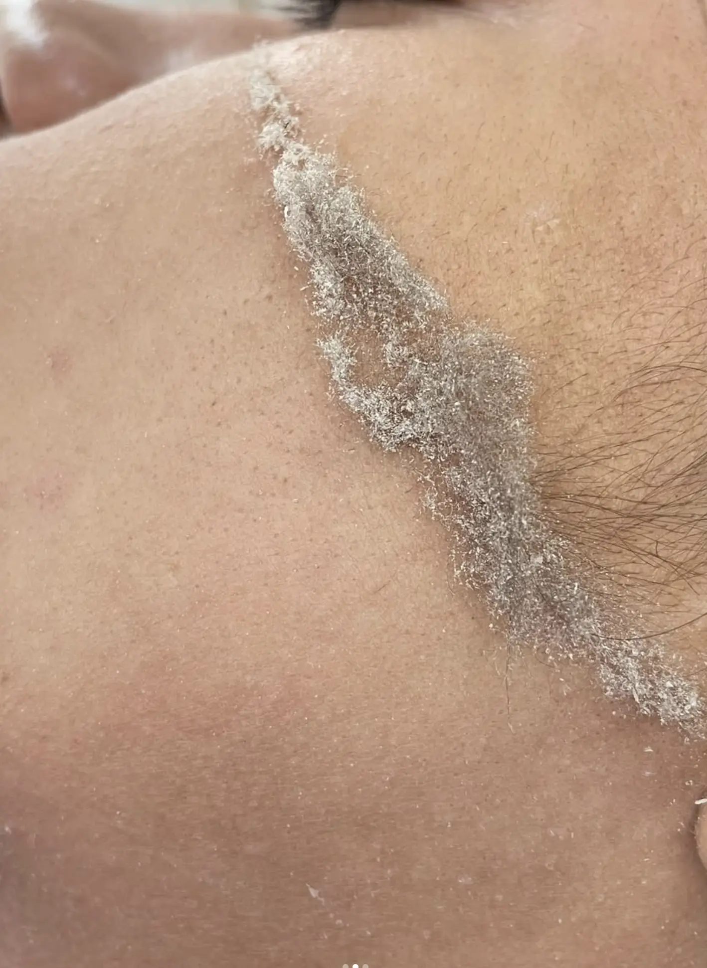 Is dermaplaning basically shaving?