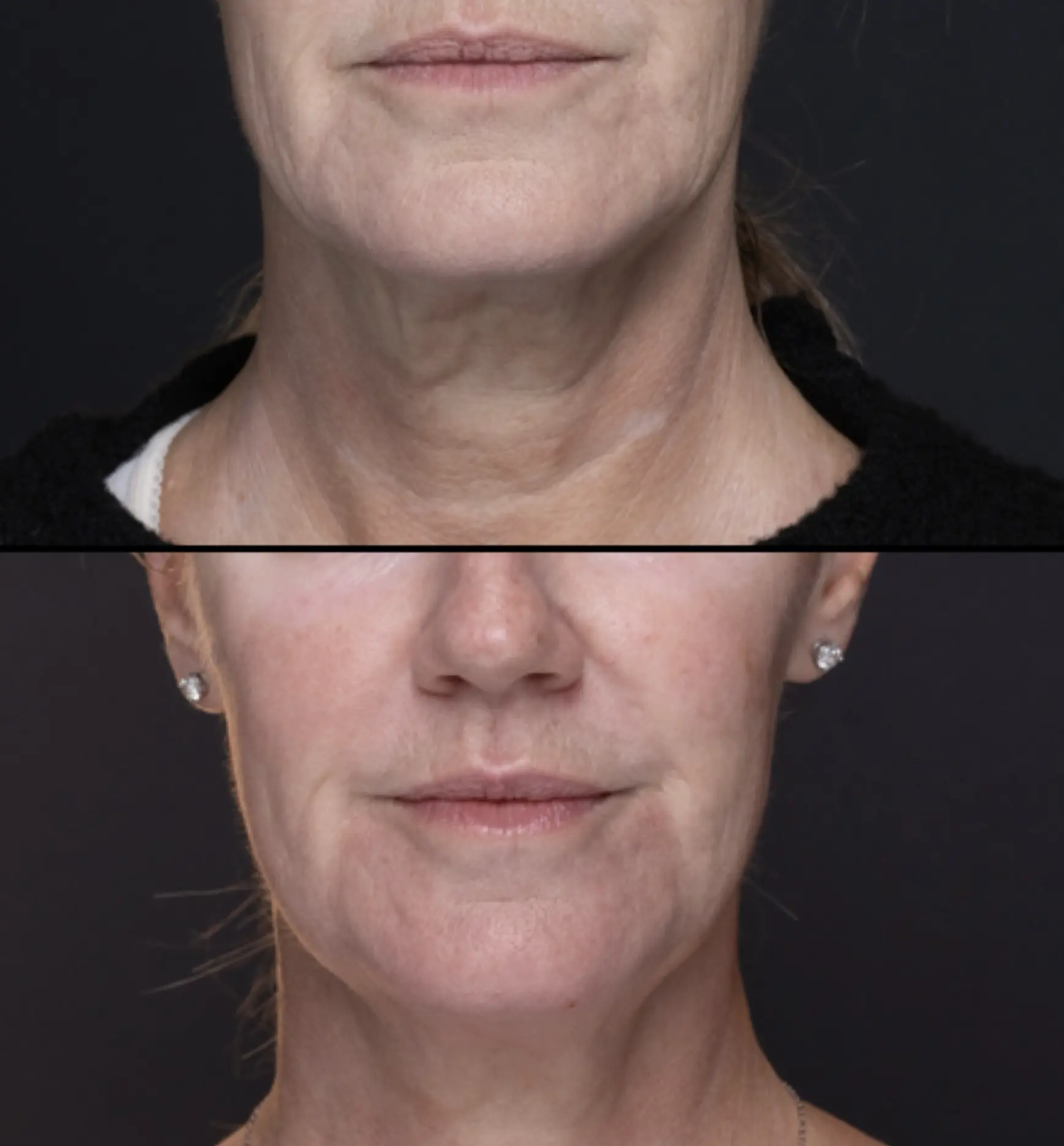 how does skin change as we age