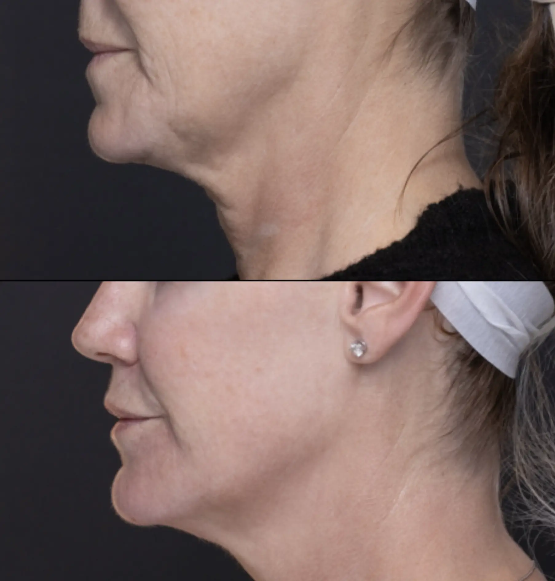 what happens to skin as we age